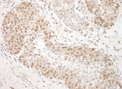 TFIP11 Antibody, Novus Biologicals 0.1mL; Unlabeled:Antibodies, Polyclonal